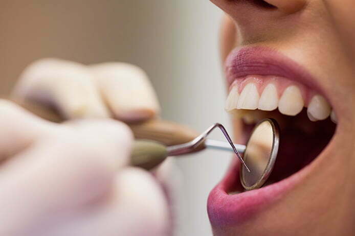 Diş Taşı Nedir, Nasıl Oluşur? Diş Taşı Temizletmek Zararlı mıdır?