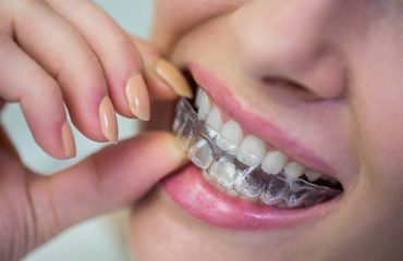 Ortodonti Tedavisinde Şeffaf Plak Dönemi