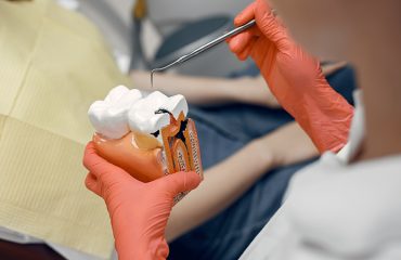 Diş Çürüğünün Yarattığı Problemler Nelerdir?